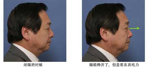 眼睛睁开了，但是看东西吃力