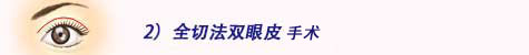 2.全切法双眼皮手术