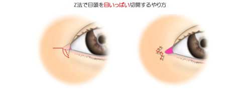 Zַ۽Ǿܵп