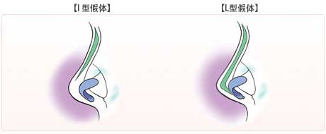 鼻中隔延長術が無かった時代の鼻の整形手術