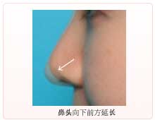 鼻头朝下前方延长