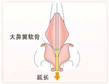 正常的延长。