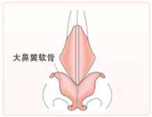 延长前的鼻子。