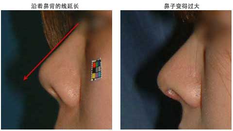 执刀医生的审美观和洞察 症例1