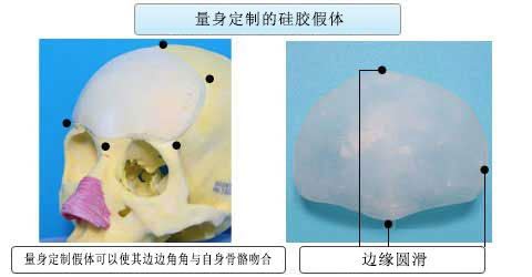 ͷǹǵ轺塣