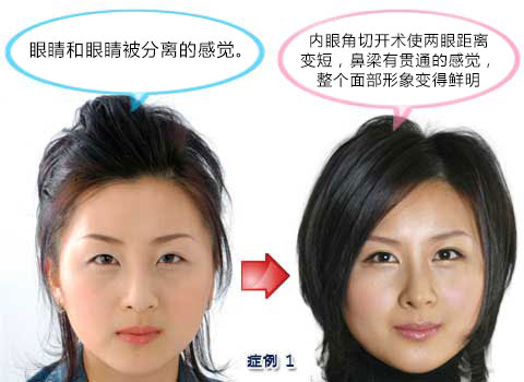 ͨ沿
