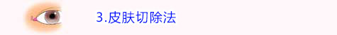 皮肤切除法