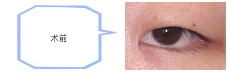 ǰ