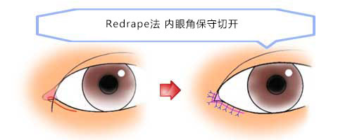 Redrape ۽Ǳп