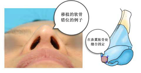 ֲܛǤ