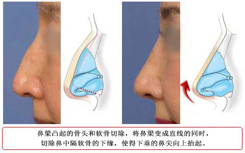 Ȥߤ뤿Ǽγɥץ饹и̿sƱȤ֤Ϥ롡֢2