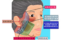 工匠的技术 面部提升